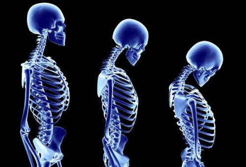 مراقب این علایم در سنین جوانی باشید