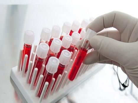 ثبت بیشتر از 9هزار نمونه در مرکز پذیره نویسی سلول های بنیادی خون ساز محک