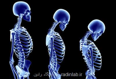 مراقب این علایم در سنین جوانی باشید