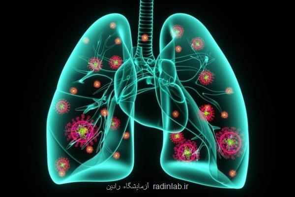 احتمال تأثیر کرونا در بروز ذات الریه