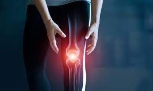 کدام خوراکی ها برای مبتلایان به آرتروز مناسب نیست؟
