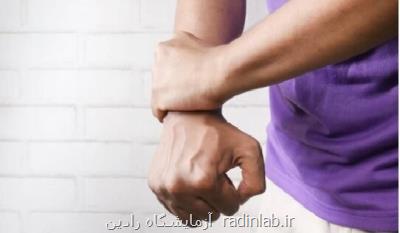 علایم اولیه آرتریت روماتوئید