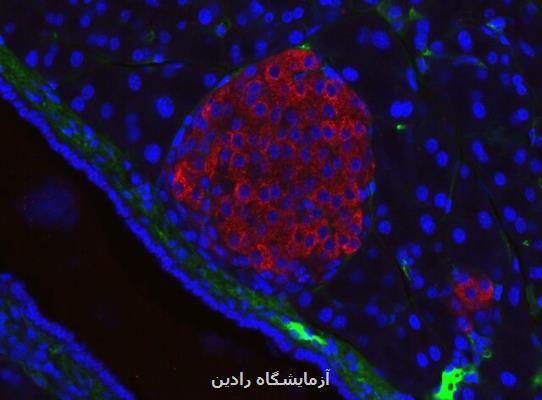 بازسازی سلول های بتا پانکراس و درمان دیابت