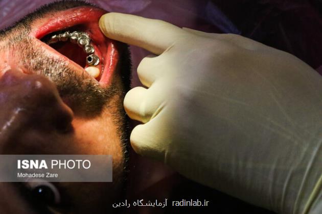 شیوع بی دندانی در ایران بعد از ۳۵ سالگی