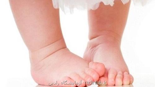 شایع ترین علت پای پرانتزی در کودکان