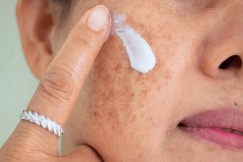اخطار مراقب سوختگی های پنهان آفتاب باشید