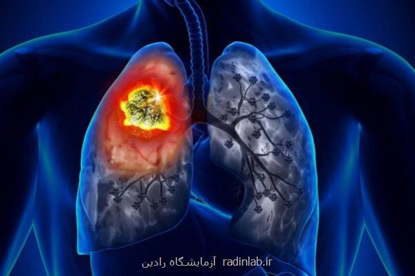 متهم اصلی سرطان ریه در ایران را بشناسید