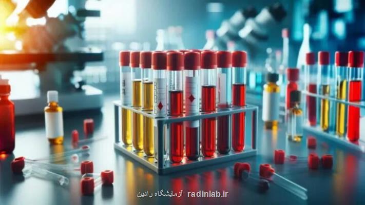 ایران به دانش فنی تولید داروهای مشتق از پلاسما دست پیداکرد