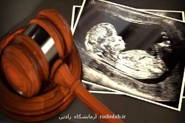 80 درصد شکایات سقط جنین خانوادگی است دشواری اثبات سقط عمدی