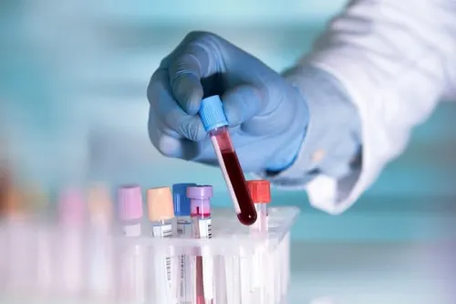 تأثیر آزمایش خون مبتنی بر DNA بر درمان سرطان گلو