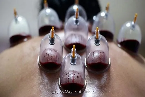 حجامت توسط افراد غیر متخصص خطرآفرین است