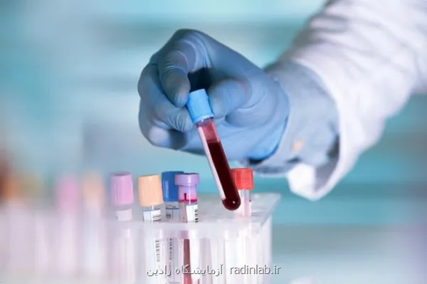 تأثیر آزمایش خون مبتنی بر DNA بر درمان سرطان گلو