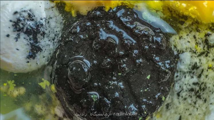 چرا معده خودش را هضم نمی کند؟