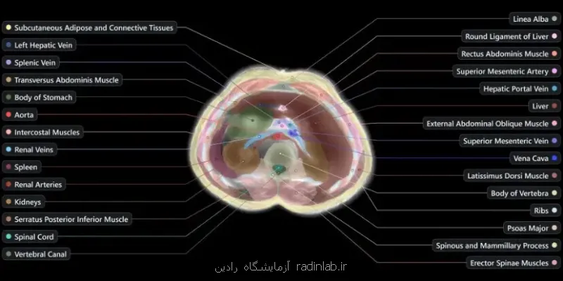 اسکن بدن بدون نیاز به دستگاه MRI