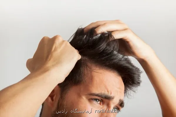 چرا برخی افراد موهای خویش را می کنند؟