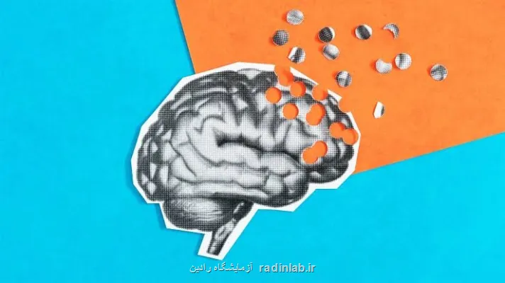 سرنخی تازه از آلزایمر